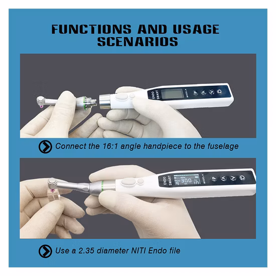 색상 옵션 경제적인 무선 LED 치과 내향 모터